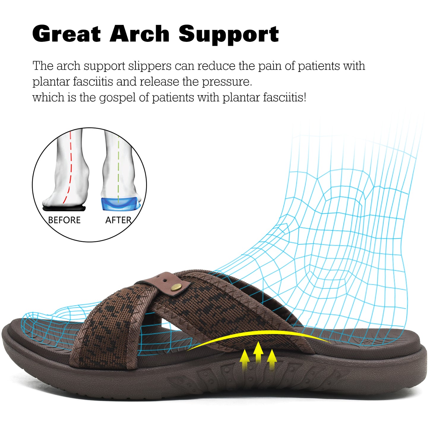 Mens Criss Cross Sandals,Arch Support Recovery Sport Slippers Slides with Plantar Fasciitis Orthotic Footbed